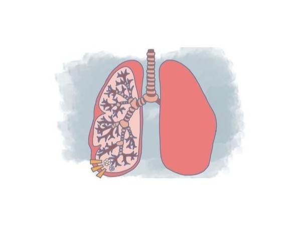 8種果蔬是對抗肺結節“法寶”，家里常備，助力恢復！