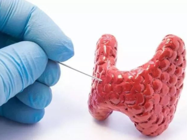 甲狀腺是怎么回事？健康生活這樣做