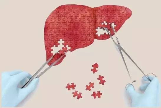 拯救不良肝臟，補(bǔ)充硒元素，真正預(yù)防肝病風(fēng)險(xiǎn)