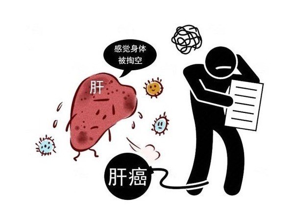 健康小知識：肝癌飲食宜忌